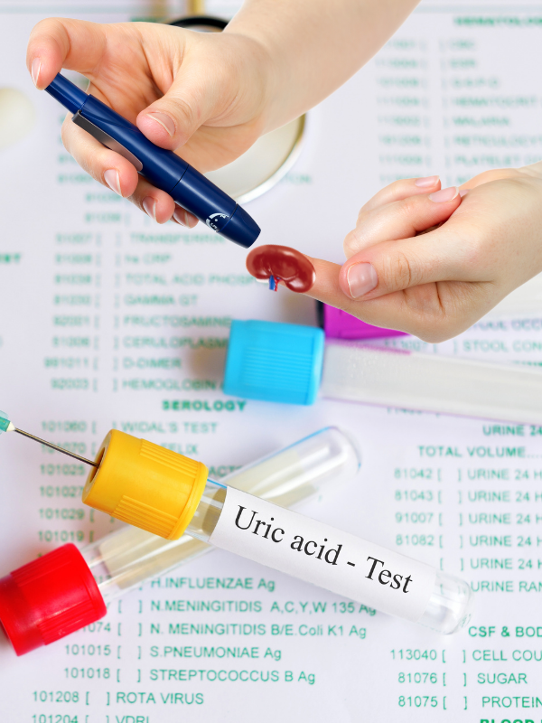 Increased serum uric acid in adolescents predicts hypertension, diabetic kidney disease